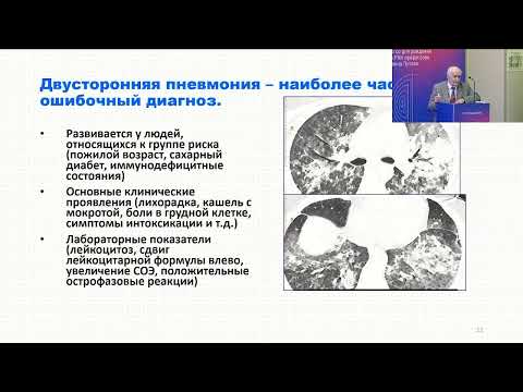 Эволюция представлений об интерстициальных заболеваниях легких