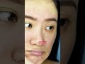 Science over trends—Dermatologist approved Glutathione Supplement | Glutone 1000