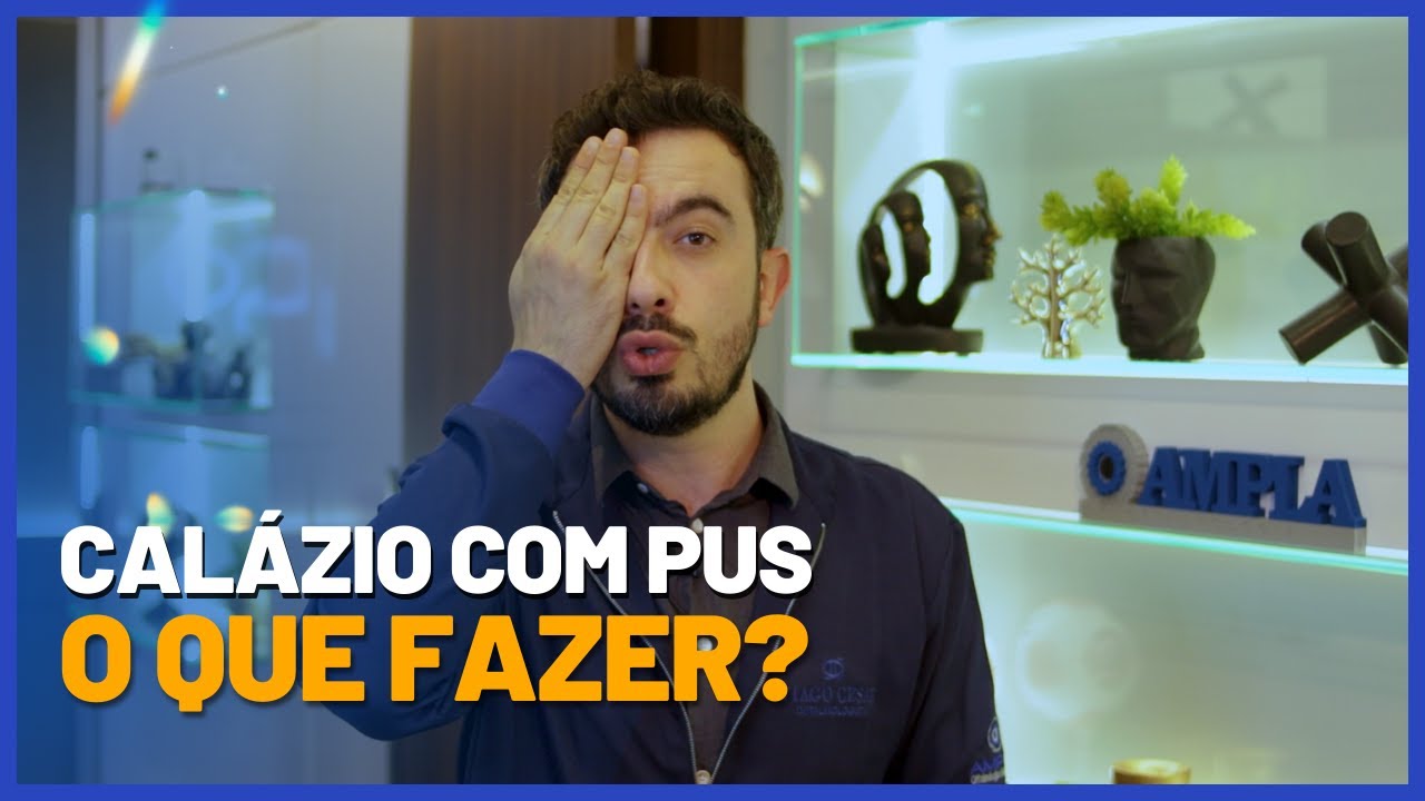 Calázio: qual o tratamento? [podcast] - PEBMED