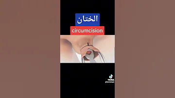 ازاى بتم عمليه الختان للولاد بالتفصيل 