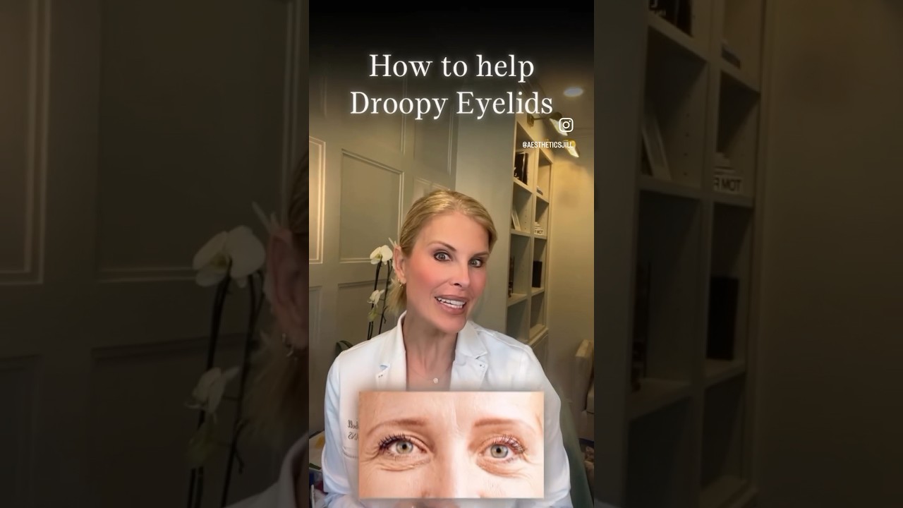 How to solve droopy eyelids. 