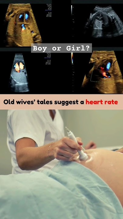 Boy Or Girl Fetal Heart Rate 148 Bpm genderreveal boyorgirl boy-or-girl-fetal-heart-rate-148-bpm-genderreveal-boyorgirl