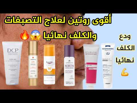 روتين طبي لتوحيد لون البشرة والتصبغات العنيدة النتيجة فاقت التوقعات