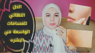 مشكلة المسامات الواسعة في الوجه وطرق لحلها