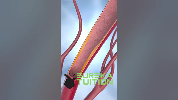 Coronary Angioplasty and Stent Insertion #animation #shorts #anatomy #science #asmr #biology #gk