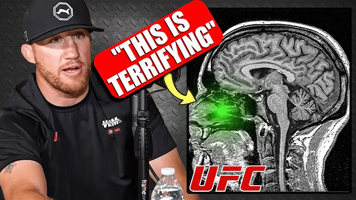 The Darkside of the UFC: Brain Trauma and CTE