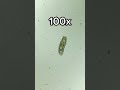Tardigrade at 0x, 40x, 100x and 400x magnification!