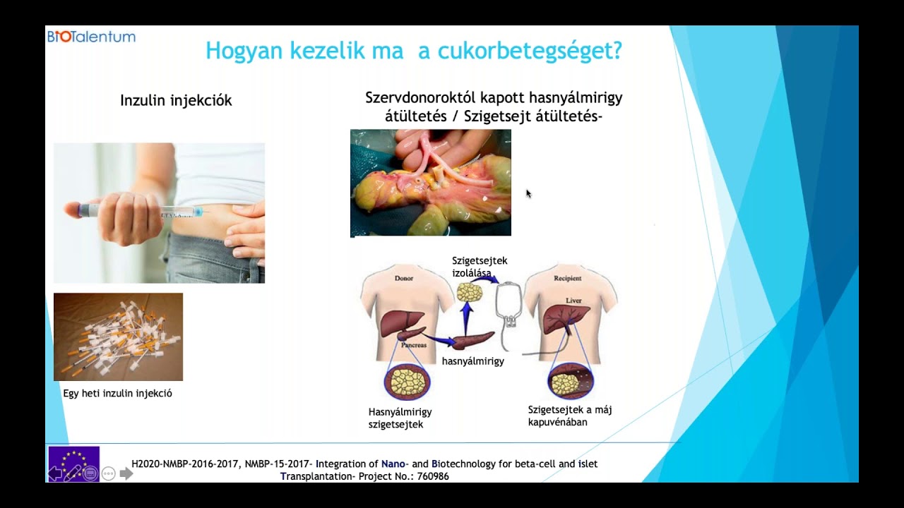 cukor diabétesz egy korai szakaszban kezelés