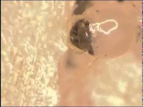 Βίντεο: Πώς αντιμετωπίζετε τους τερμίτες;