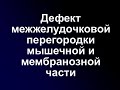 ДМЖП мышечной и мембранозной части. Видео 90-х годов.