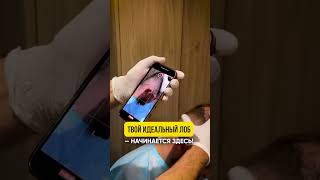 Любая зона пересадки  за 50.000 рублей.