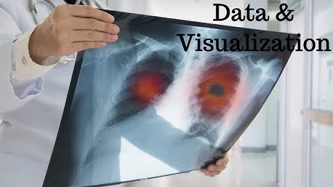 COVID-19 Chest X-RAY Detection using Deep Learning - Visualizing the Dataset  Part 3