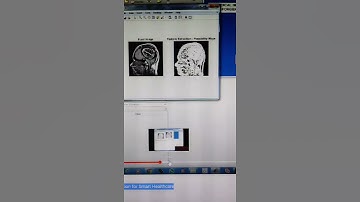 Medical Image Forgery Detection for Smart Healthcare | MATLAB PROJECT