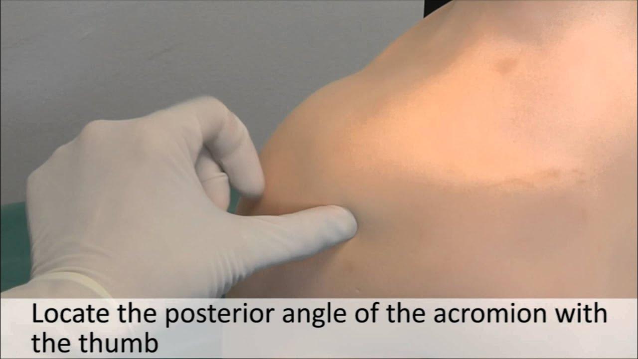 Musculoskeletal Examination and Joint Injection Series_ Shoulder Joint Aspiration(Posterior