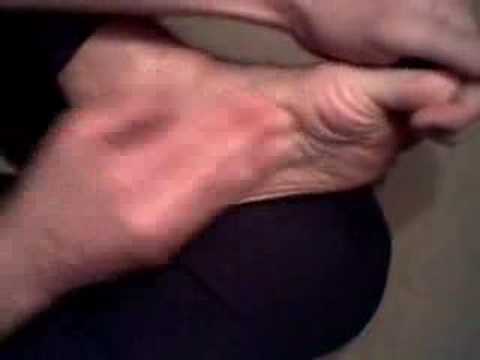 foot cramp - YouTube
