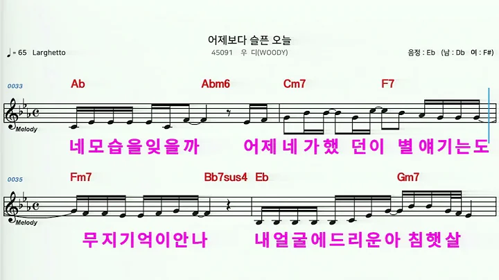 (MR)  45091  어제보다슬픈오늘 - 우디