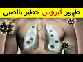 لا علاج له.. فيروس شديد العدوى يثير الهلع في الصين - ماهو فيروس HMPV كورونا الجديد ؟