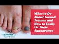 What to Do About Toenail Trauma and How to Easily Fix Their Appearance