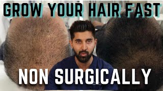 Grow Your Hair Without Surgery | At Home & In Clinic Options | Doctor recommended