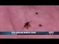 “My Whole Body Hurt”: Botetourt Man Gets Unusual Tick Disease
