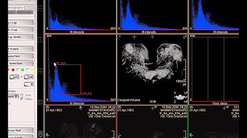 MammoExplorer: An Advanced CAD Application for Breast DCE-MRI