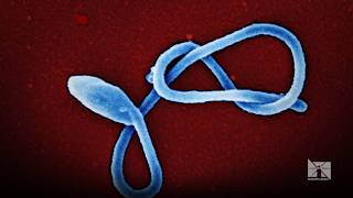 American doctor tests positive for Ebola amid ongoing outbreak