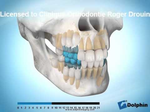 Sequence D Eruption Des Dents Youtube