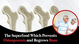 This Super Food Can Stop Osteoporosis And Build Bone Density