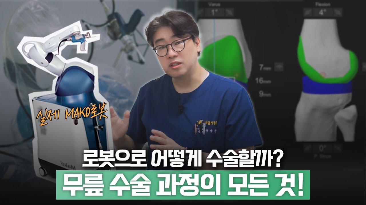 무릎 인공관절 로봇수술 과정 공개! 0.1mm 오차도 허용 안 하는 이유 (ft. 마코 로봇)