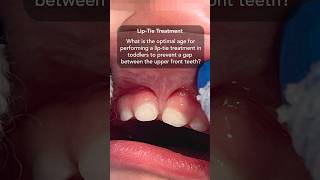 Lip-Tie and Gap Between Front Teeth. What Is the Optimal Age for Treatment in Infants and Toddlers? screenshot 1