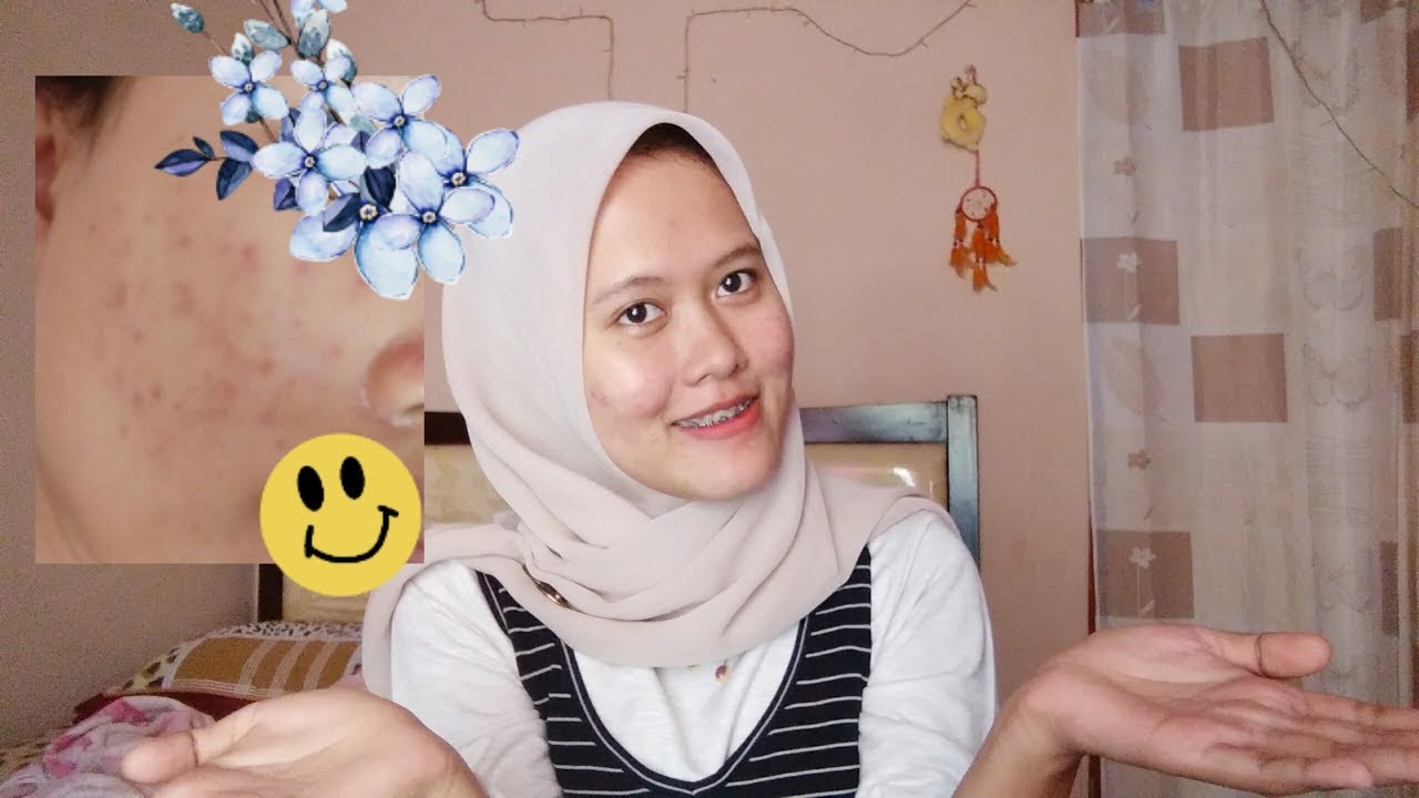 Skincare menghilangkan jerawat/bekas jerawat dan cara aku