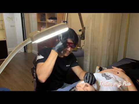 Video CA XÓA XĂM VIỀN MÔI BỊ LOANG MÀU BẰNG LASER PICOSURE l... - youtube