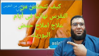 كيف تتخلص من النقرس نهائيا فى أيام العلاج النهائى للنقرس والاملاح وارتفاع حمض اليوريك فى الدم