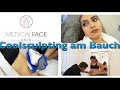 MEINE COOLSCULPTING BEHANDLUNG AM BAUCH l MEIDCALFACE KÖLN l FAMILIE SAID