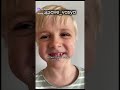 ‼️Срочный сбор‼️. Вася Ловыгин. Миодистрофия Дюшенна