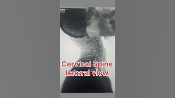 Xray Cervical spine lateral view #radiologist #medicalimaging #radiologycareer #radiology #edit