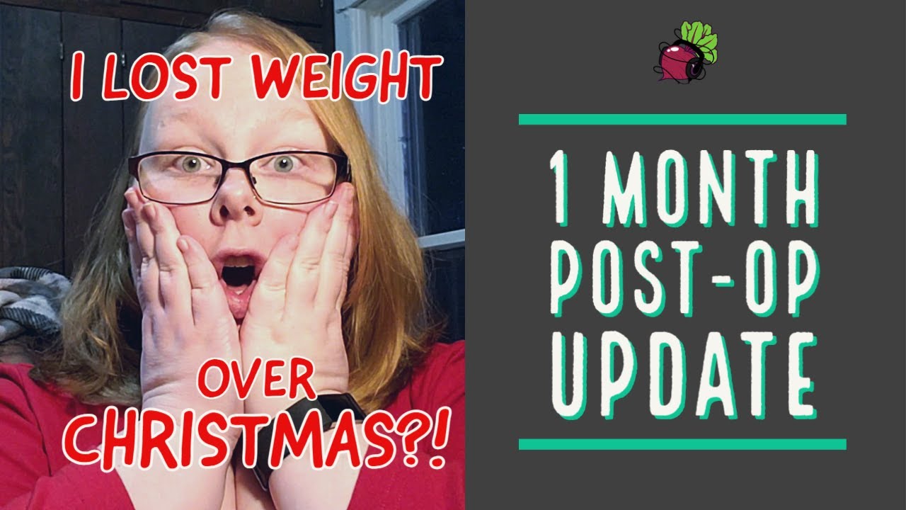Операция по снижению веса: обзор через месяц после операции | Мой опыт желудочного шунтирования