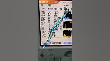 Difference Between 5 and 3 Parts Haematology Analyzer #mlt #youtuber #shortvideo