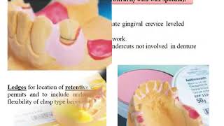 modifications of master cast د. ابراهيم التركي screenshot 5