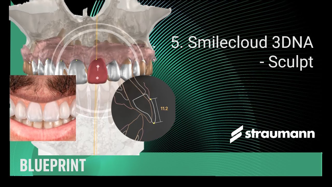 Smilecloud 3DNA - Sculpt