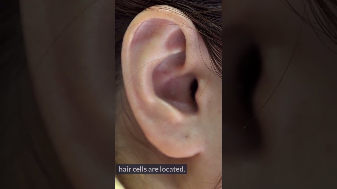 Tinnitus EXPOSED Surprising Causes Of Ringing In Ears 5