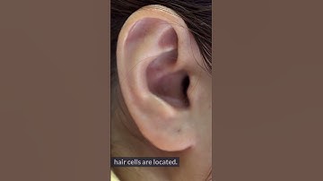 Tinnitus EXPOSED - Surprising Causes of Ringing in Ears #5