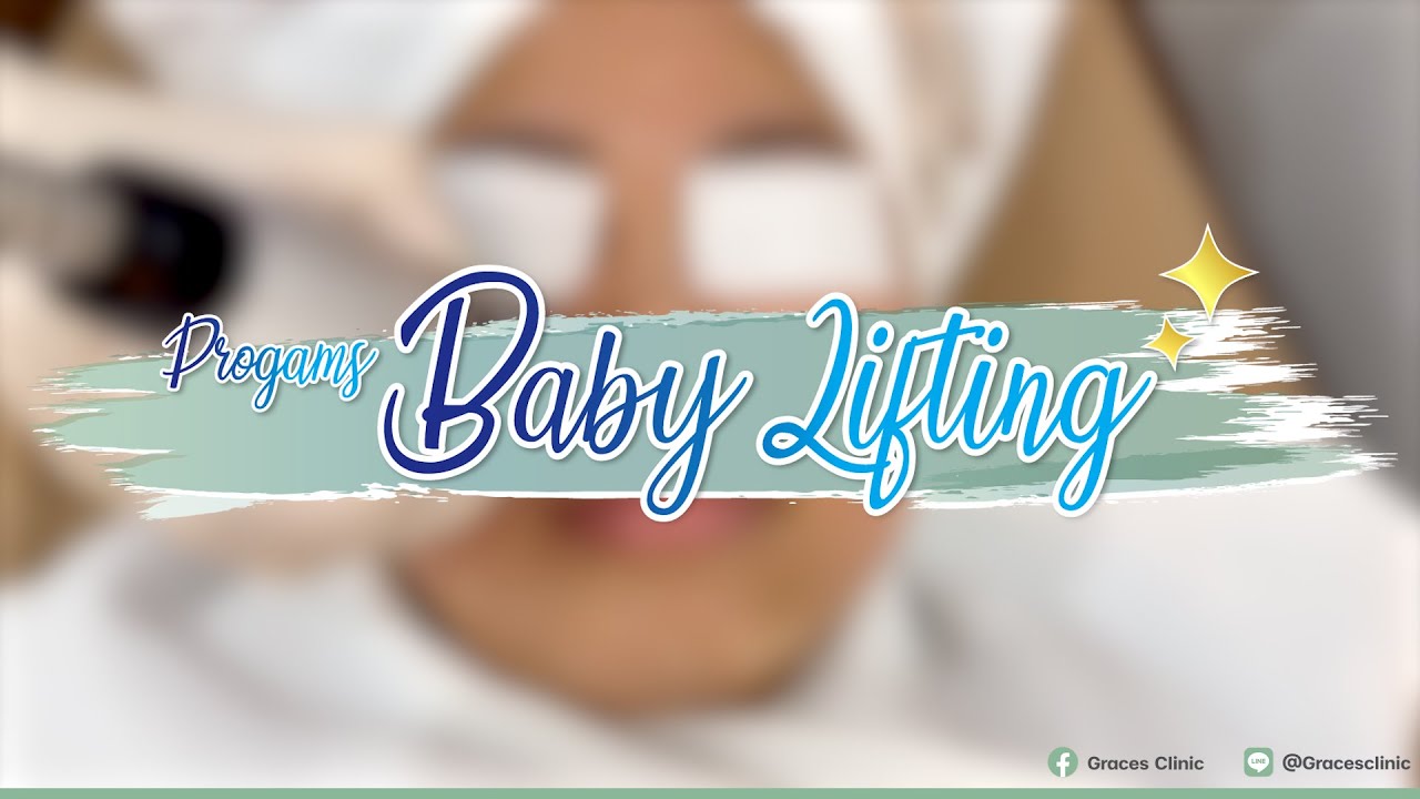 Baby Lifting By Graces Clinic YouTube