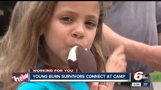 Young Burn Survivors Connect at Camp