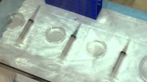 Isolating Stem Cells from Soft Musculoskeletal Tissues