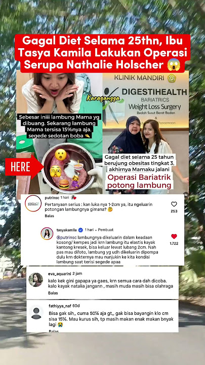 nampak l4mbun9 ibu Tasya Kamila stelah diptong😰