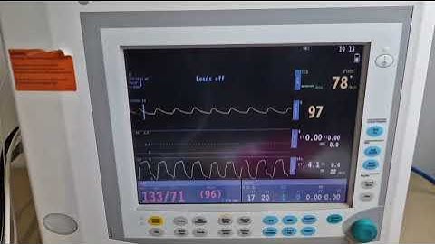 MRI mri compatible ge datex ohmeda S5 patient monitor AA gas module