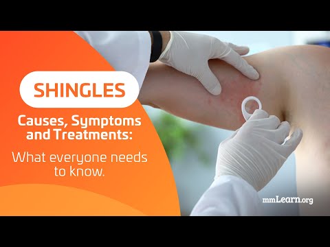 Video: Shingles Internal: Gambaran Umum, Penyebab, Gejala, Dan Banyak Lagi