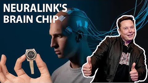 Neuralink’s First Human Brain Chip Implant – A Game-Changer in AI & Neuroscience!