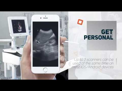 Cart ultrasound gets personal